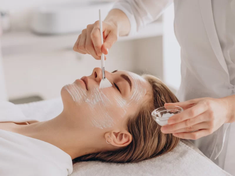 Peeling Químico​
